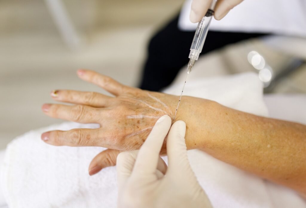 Hilos de bioestimulación rosario (1)